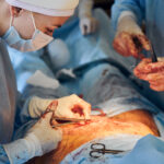 Care After Cesarean Delivery